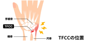 TFCC解剖