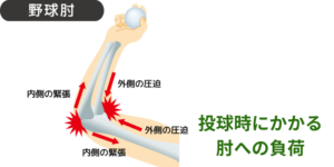 投球時の肘にかかる負荷