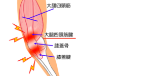 大腿四頭筋腱解剖図